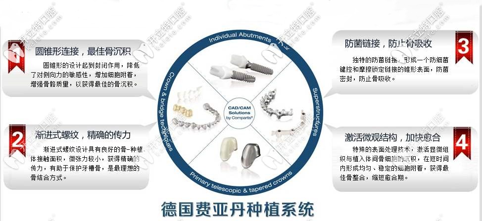 德國(guó)ankylos種植體介紹