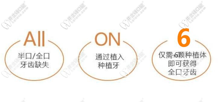用以色列科特斯Saturn這款植體做all-on-6半口即刻負重