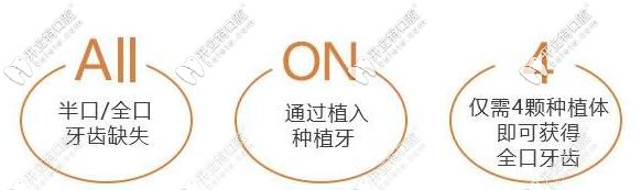 all-on-4種植技術