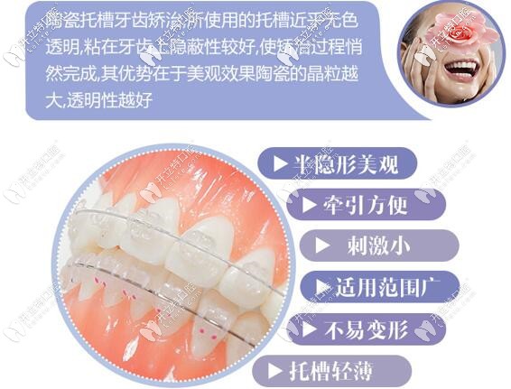 深圳微爾口腔美國(guó)3M陶瓷半隱形牙齒矯正價(jià)格