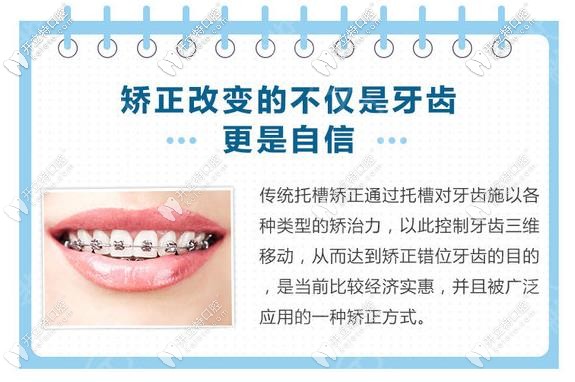 傳統(tǒng)的鋼絲矯正優(yōu)勢(shì)