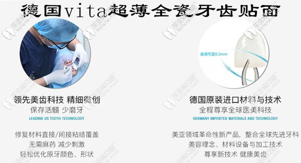 德國vita超薄瓷貼面不磨牙也不會脫落