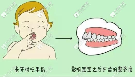 導致錯頜畸形的緣故