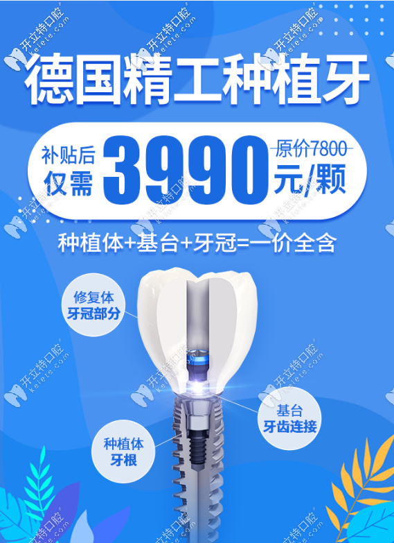 西安諾貝爾德國進(jìn)口種植牙價(jià)格