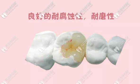 嵌體具有不錯的耐磨性