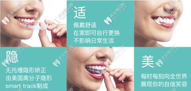 隱適美隱形矯正的優(yōu)勢