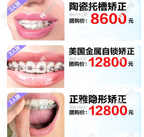 廣州家庭醫(yī)生口腔的正畸拼團價介紹