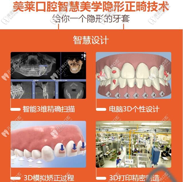 深圳美萊口腔美學正畸技術