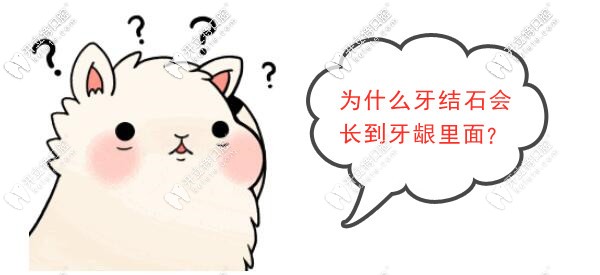 為什么牙結(jié)石會長到牙齦里面？