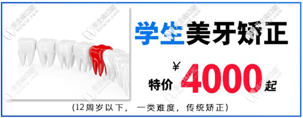 在淮安牙知道做mrc兒童矯治器價(jià)格低到4000起-活動(dòng)沒幾天了