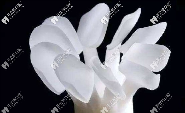 瑞士進(jìn)口Emax全瓷牙貼面實例
