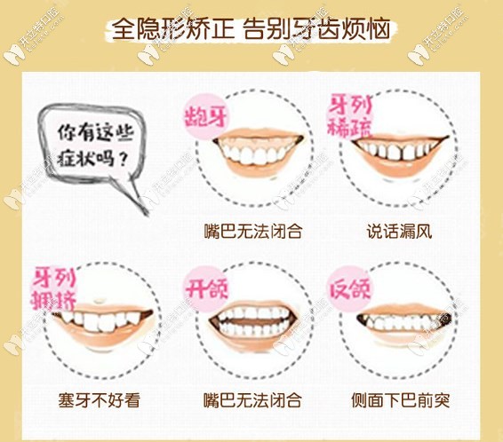 時代天使隱形矯正適應癥