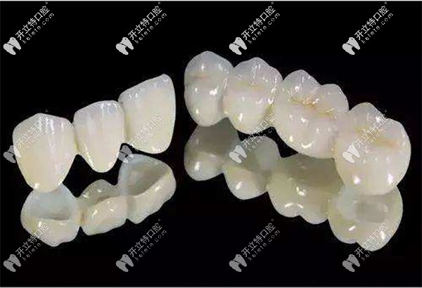沈陽(yáng)百嘉麗全瓷冠