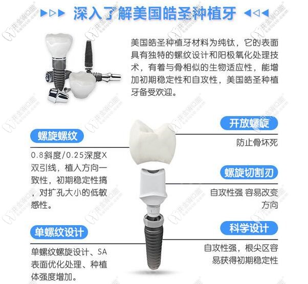 深圳弘和口腔美國(guó)皓圣種植牙怎么樣