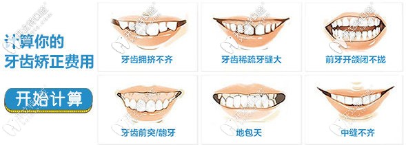 搜集到一份信陽伢牙齒科做牙齒矯正的價(jià)格表前來分享