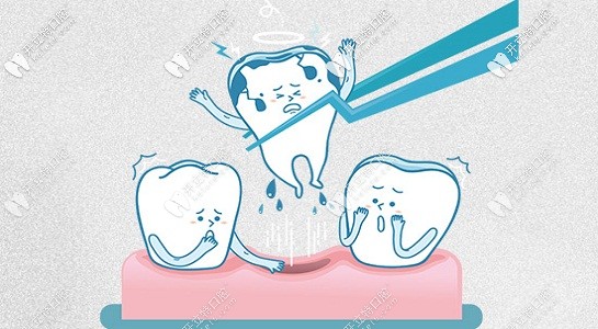 拔牙要根據(jù)情況收費