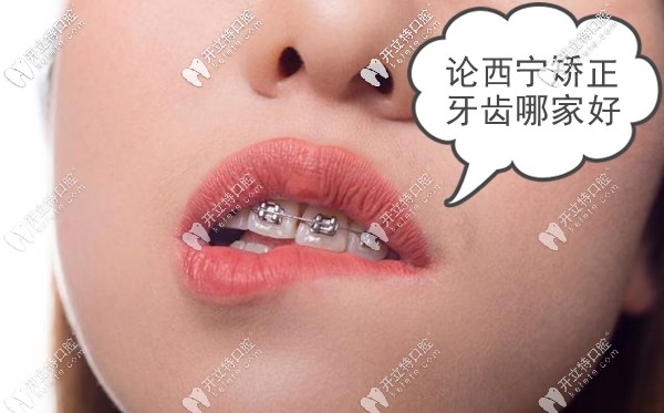 進來聊聊關(guān)于西寧市做牙齒矯正哪家牙科醫(yī)院好這個話題