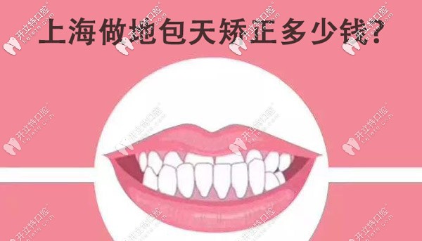 想知道在上海正規(guī)牙科做地包天矯正的費(fèi)用大概是多少嗎？