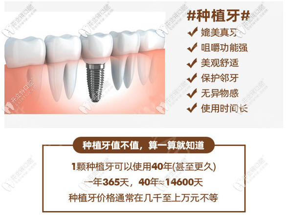 種植牙的優(yōu)勢(shì)