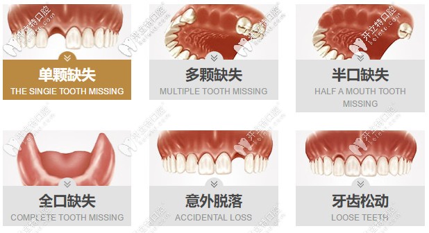 找這份合肥貝杰口腔做種植牙的價(jià)格表不容易，請(qǐng)珍惜~