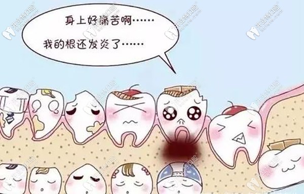 再和你聊聊發(fā)炎和干槽癥的區(qū)別？干槽癥前兆是啥樣？