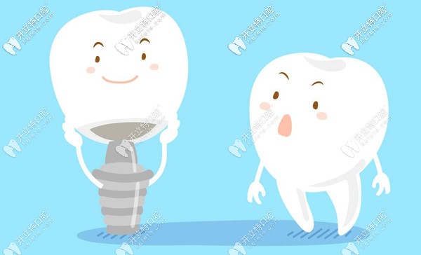 解鎖佛山曙光金子口腔種植牙多少錢一顆？技術(shù)可靠嗎~