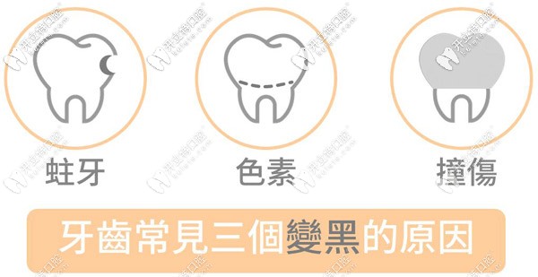 兒童牙齒黑斑是什么原因引起的，需要治療嗎？