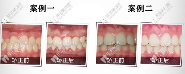 重慶團(tuán)圓私立口腔醫(yī)院到底好不好？是連鎖牙科么？