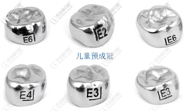 兒童預(yù)成冠示意圖