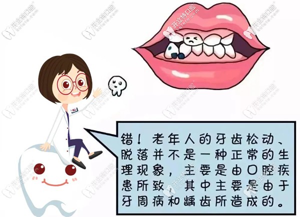 50歲全口牙松動，做即拔即種即刻負(fù)重全口種植牙吃飯香啦~