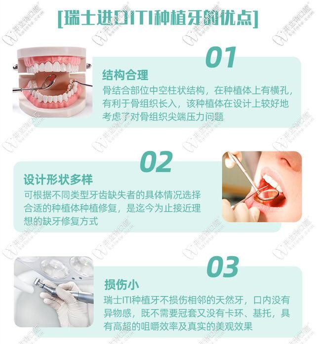 向輝主任介紹——瑞士進口iti種植牙的優(yōu)點