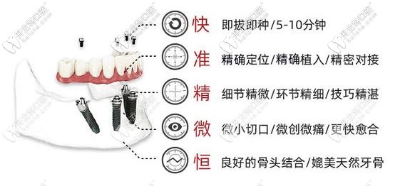 即刻種植、即刻負重技術(shù)優(yōu)勢