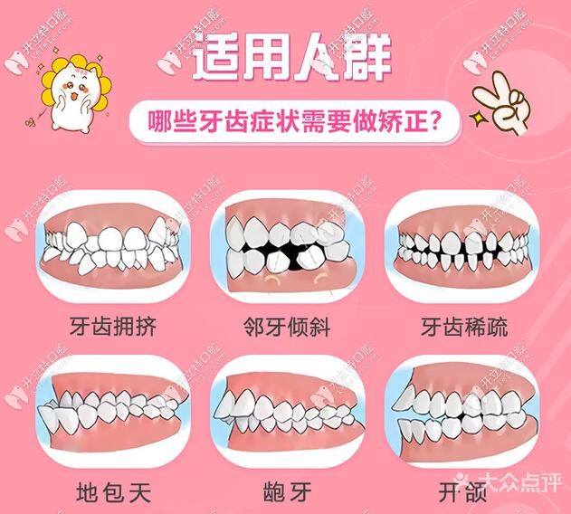 哪些牙齒問(wèn)題需要矯正