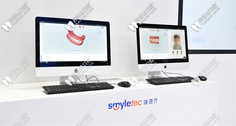 瑞速齊隱形矯正價(jià)格是多少錢？Smyletec是哪個(gè)國(guó)家的？
