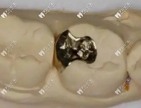 醫(yī)生技術(shù)不豐富，材料填充不嚴(yán)密