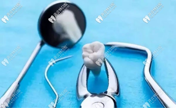 運(yùn)用超聲骨刀拔牙的優(yōu)點(diǎn)