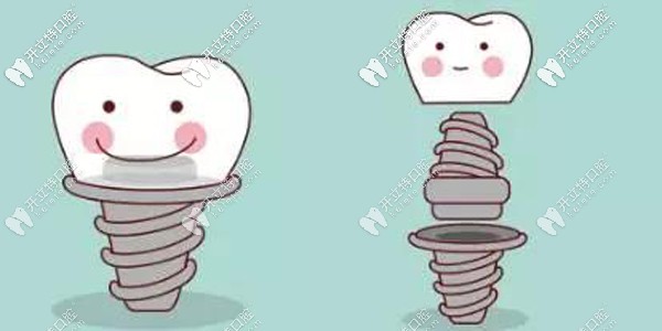 綿陽口腔醫(yī)院收費(fèi)標(biāo)準(zhǔn)更新，種植牙/矯正牙齒價(jià)格同步更新~