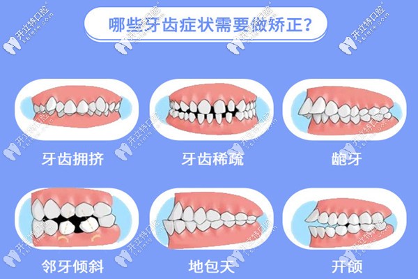 寶山區(qū)羅緣口腔正畸技術(shù)怎么樣