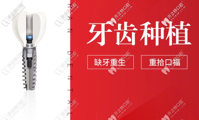 貴陽德韓口腔種植牙怎么樣？種牙技術(shù)好的醫(yī)生介紹奉上