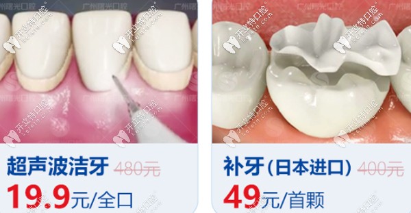 曙光口腔洗牙、補(bǔ)牙優(yōu)惠看這