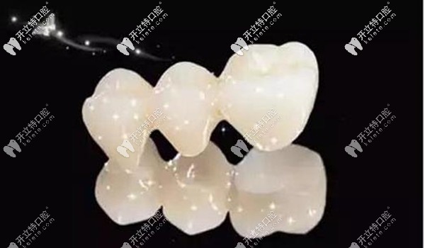 西安美奧口腔全瓷牙價格就在這,不要擔(dān)心國產(chǎn)愛爾創(chuàng)收費(fèi)貴