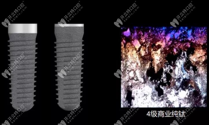 德國(guó)進(jìn)口種植體品牌camlog好不好？看其材質(zhì)性價(jià)比蠻高的