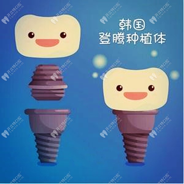 昆明做韓國(guó)純鈦登騰種植牙補(bǔ)貼價(jià)2399元一顆，也太便宜了吧