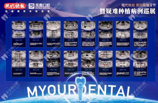 美奧口腔疑難種植病例巡展