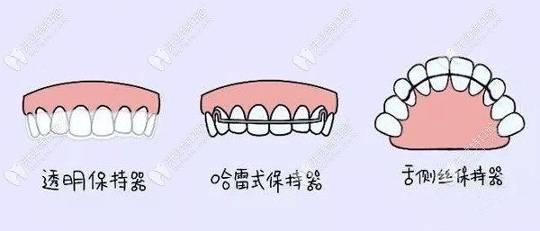 常見(jiàn)保持器類(lèi)型