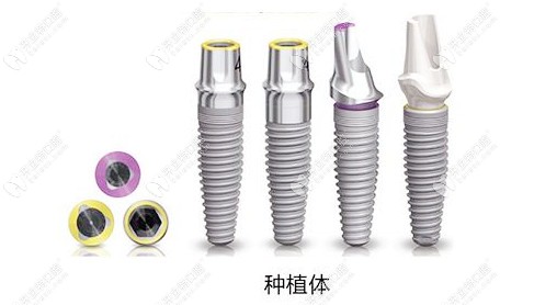 分享沈陽盛大口腔價格表，盛大做種植牙口碑好價格還不貴