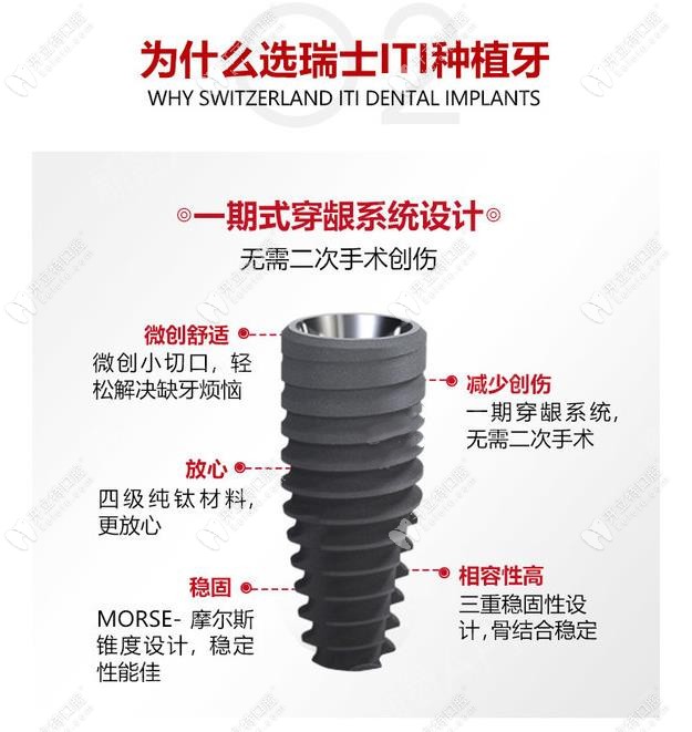 瑞士iti士卓曼種植體好嗎？